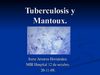 TB y Mantoux_Sesion area 11_IreneAmores