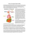 What are the Symptoms of Swine Flu H1N1?
