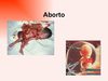 ABORTO