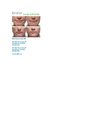 Radiesse - Locate A Provider - Santa Monica, Los Angeles, Beverly Hills