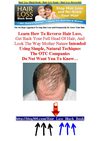 Hair Loss Black Book - Hair Loss Scam - Hair Loss Reversible