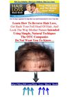 Hair Loss Solution - Hair Loss Children - Hair Loss Cures