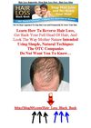 Hair Loss Regrowth - Stop Hair Loss Now - Hair Loss Men