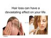  Hair Loss Black Book - Stop Hair Loss Re-Grow Your Hair