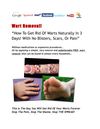Wart Removal - How To Get Rid Of Warts Naturally In 3 Days! With No Blisters Scars or Pain