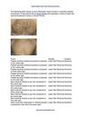 Body details laser hair removal aventura