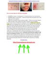  treatment for molluscum contagiosum - molluscum contagiosum treatment at home