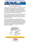 gallstone remedy - gallstone attack diet - gallstone treatment diet