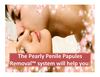 Pearly Penile Papules Removal at Home