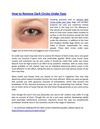 How to Remove Dark Circles Under Eyes