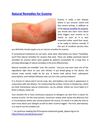 Natural Remedies for Eczema