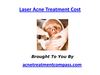 Laser Acne Treatment Cost