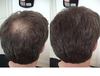 Crecer el Cabello Rapido Crecimiento