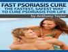 How To Cure Psoriasis Fast - Fast Psoriasis Cure