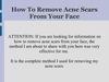 How To Remove Acne Scars