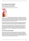 How to Remove Stretch Marks?