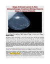 Stage 4 Breast Cancer A New Immunotherapy Treatment Brings Hope to Stage 4 Cancer Patients