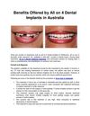 all on 4 dental implants - all on four australia
