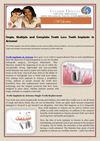 Single, Multiple and Complete Tooth Loss: Teeth Implants in Arizona!