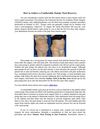 Tummy Tuck After Weight Loss