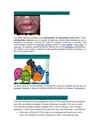 Algunas Enfermedades de Transmisión Sexual