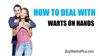 How To Deal With Warts on Hands