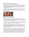 Things to remember by a San francisco plastic Surgeon
