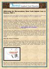 Obliterating the Misconceptions About Tooth Implant Costs in Houston, PART 3