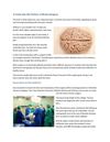 A Look into the Future of Brain Surgery